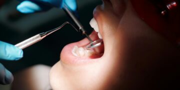 Маж со 42 заби влезе во Гинисовата книга на рекорди